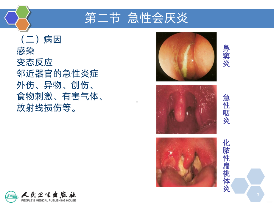 喉科病人的护理PPT课件.ppt_第3页