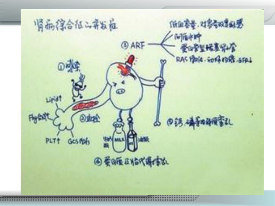 肾病综合征患儿的护理-ppt课件.ppt_第2页