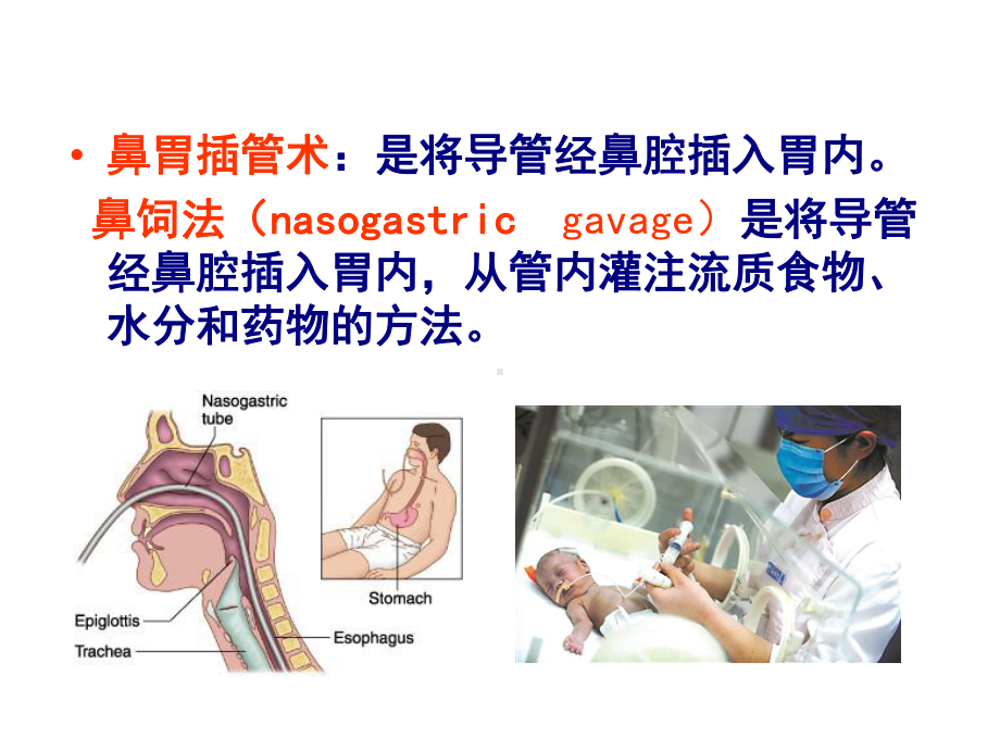 小儿胃管置入术-PPT医学课件.ppt_第2页