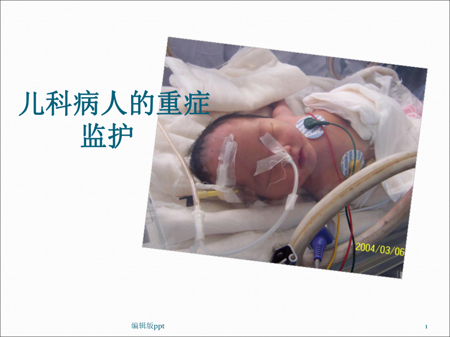 儿科病人的重症监护课件.ppt_第1页