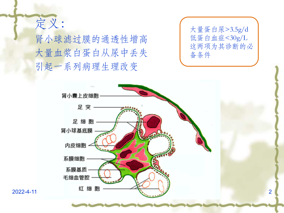 儿科肾病综合症PPT课件.ppt_第2页