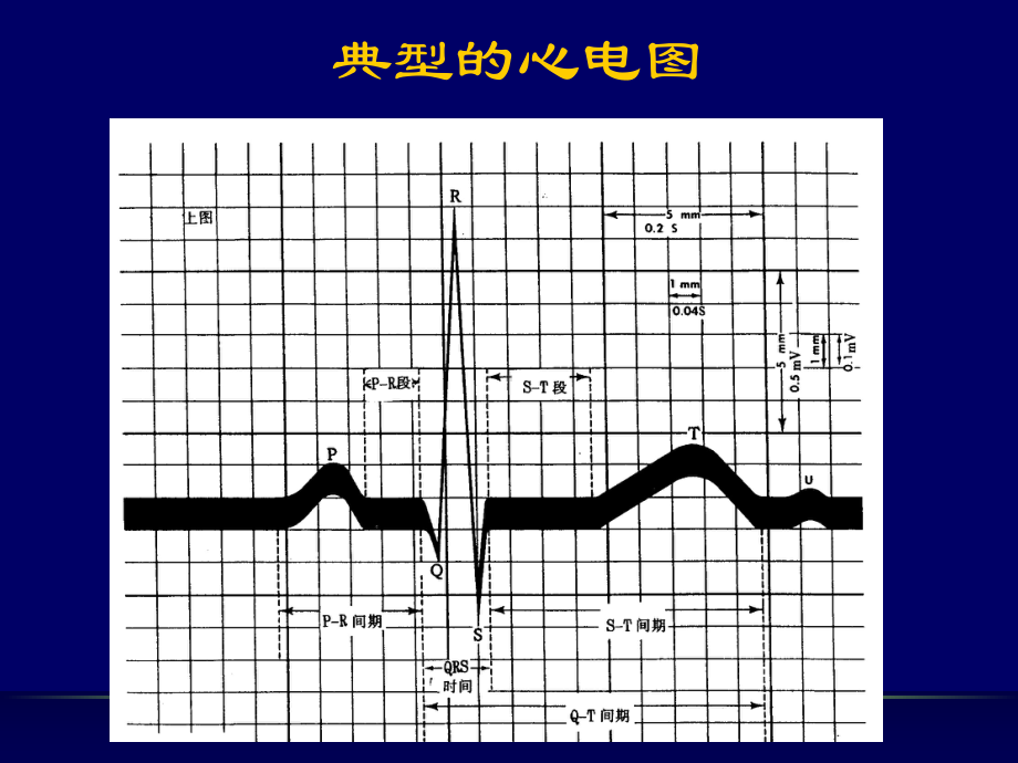 儿童心电图-ppt课件.ppt_第3页