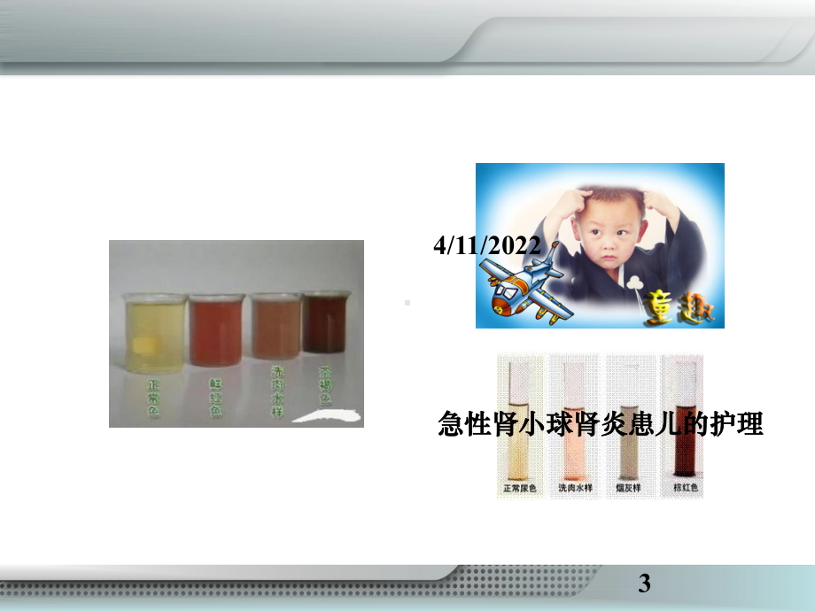 急性肾小球肾炎患儿的护理培训课件.ppt_第3页