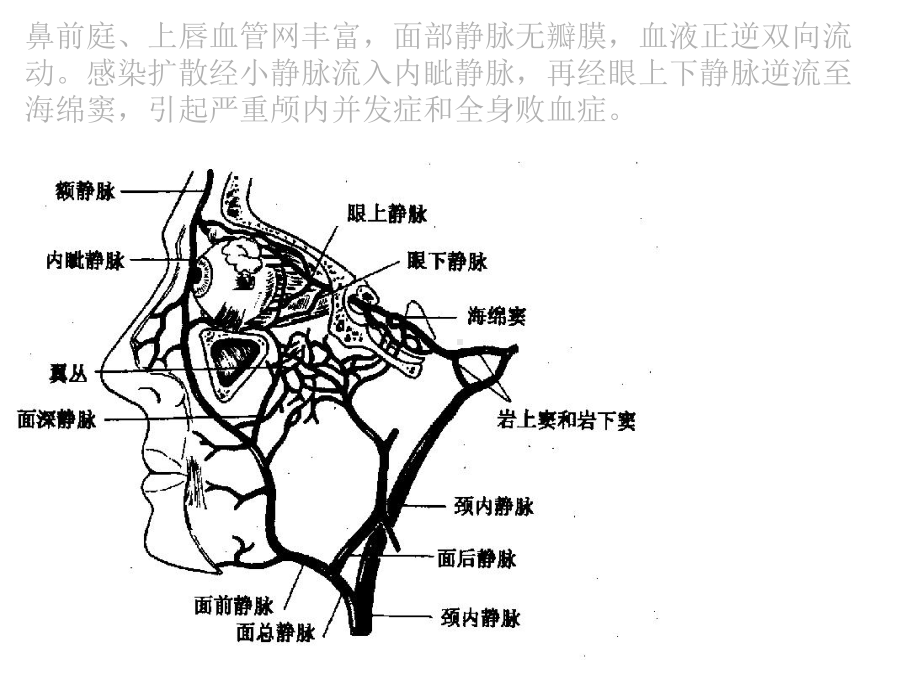 窦口鼻道复合体(OMC)解剖结构及临床意义课件.ppt_第3页