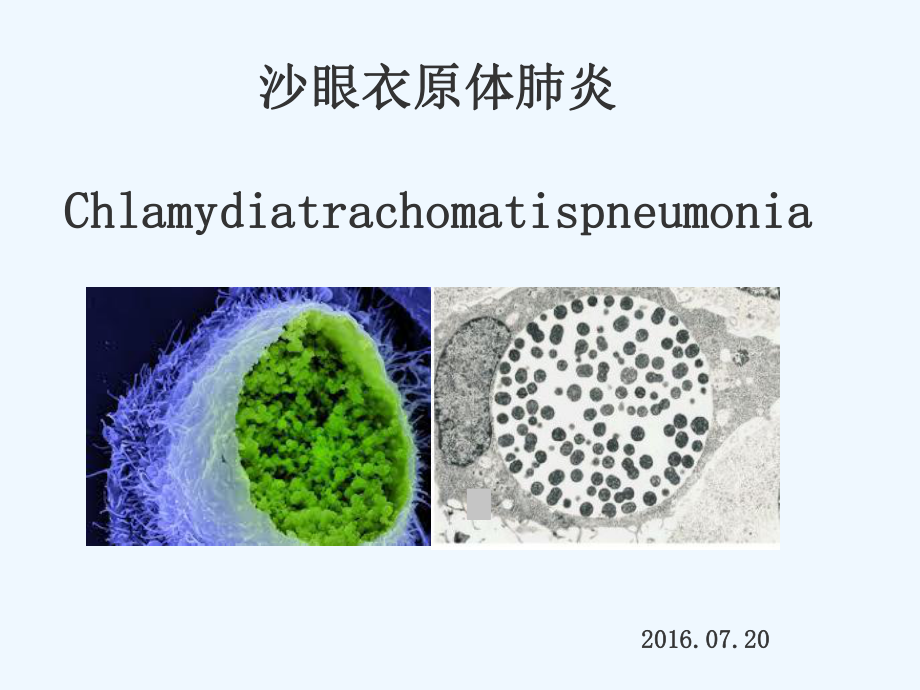 婴儿沙眼衣原体肺炎课件.ppt_第1页