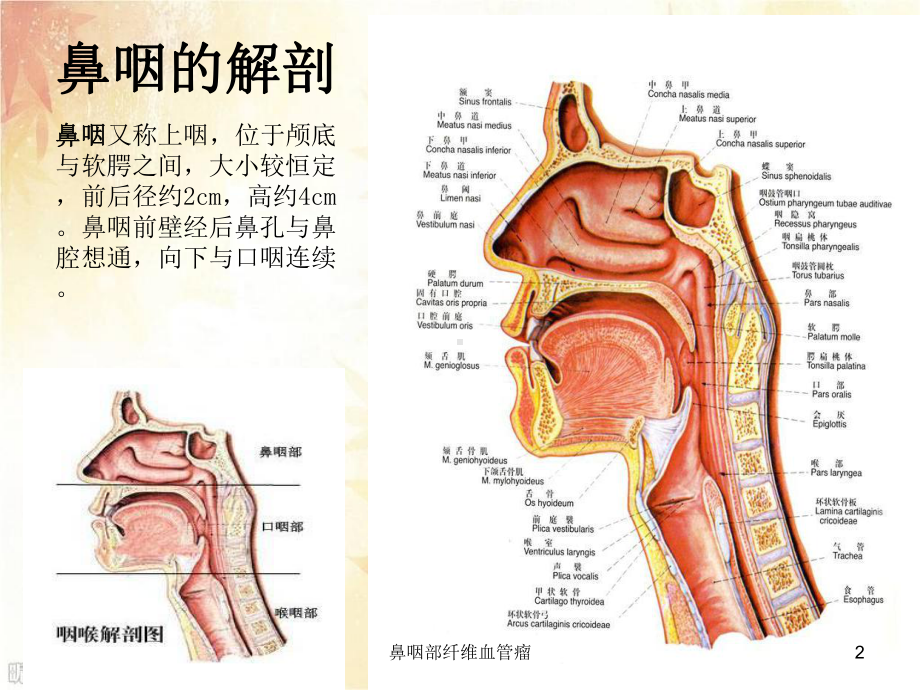 鼻咽部纤维血管瘤培训课件.ppt_第2页