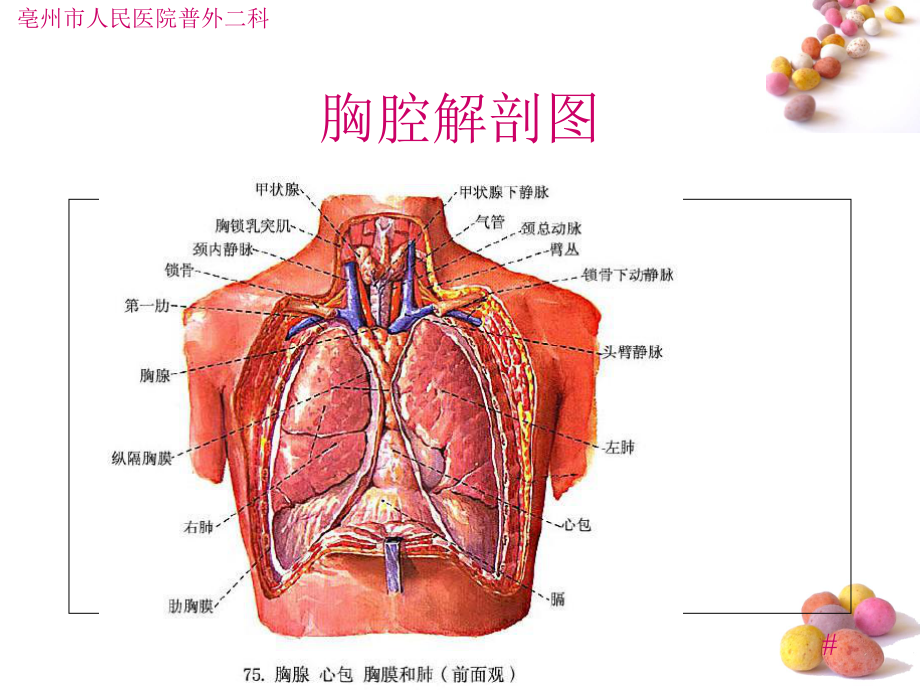 小儿膈疝的护理查房..复习进程课件.ppt_第2页