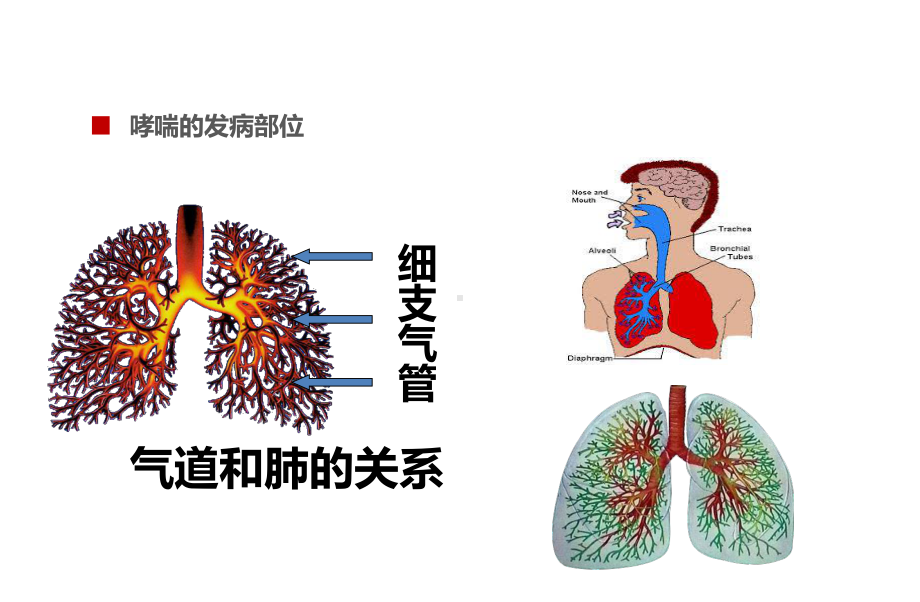 最新儿童哮喘防治主题讲座课件.ppt_第2页