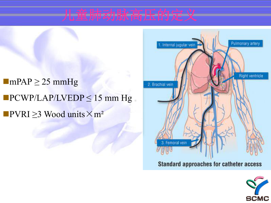 最新儿童肺动脉高压的特点主题讲座课件.ppt_第2页