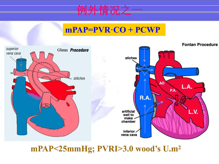 最新儿童肺动脉高压的特点主题讲座课件.ppt_第3页