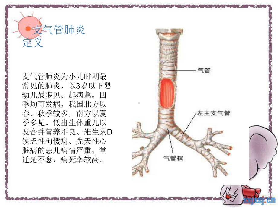 护理查房-小儿支气管肺炎整理版课件.ppt_第2页