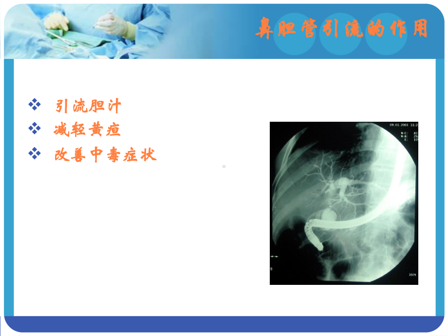 鼻胆管引流术护理PPT课件.ppt_第2页