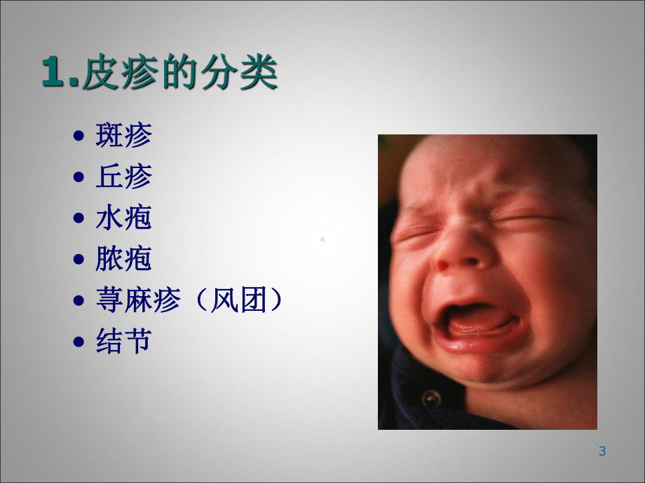 小儿常见皮疹鉴别与诊断PPT课件.ppt_第3页