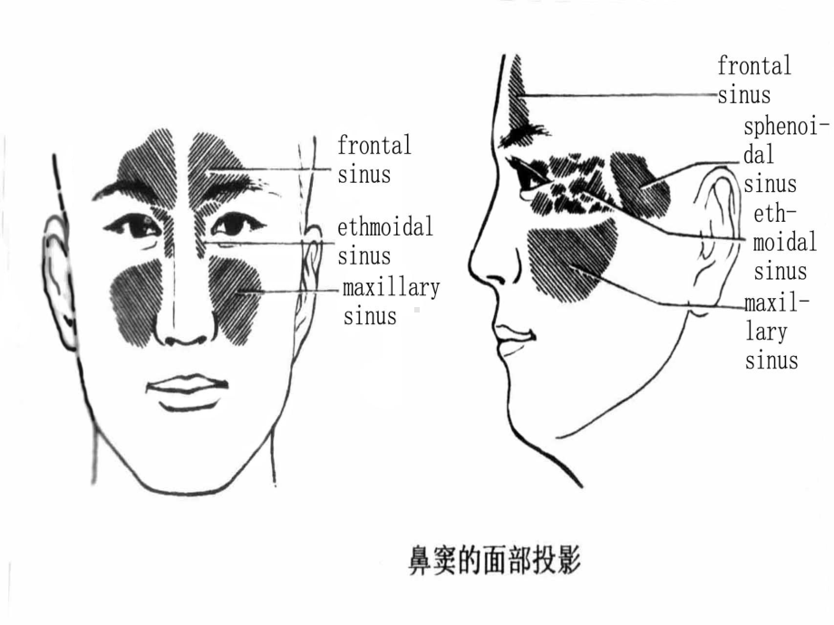 鼻窦炎英文版PPT培训课件.ppt_第2页