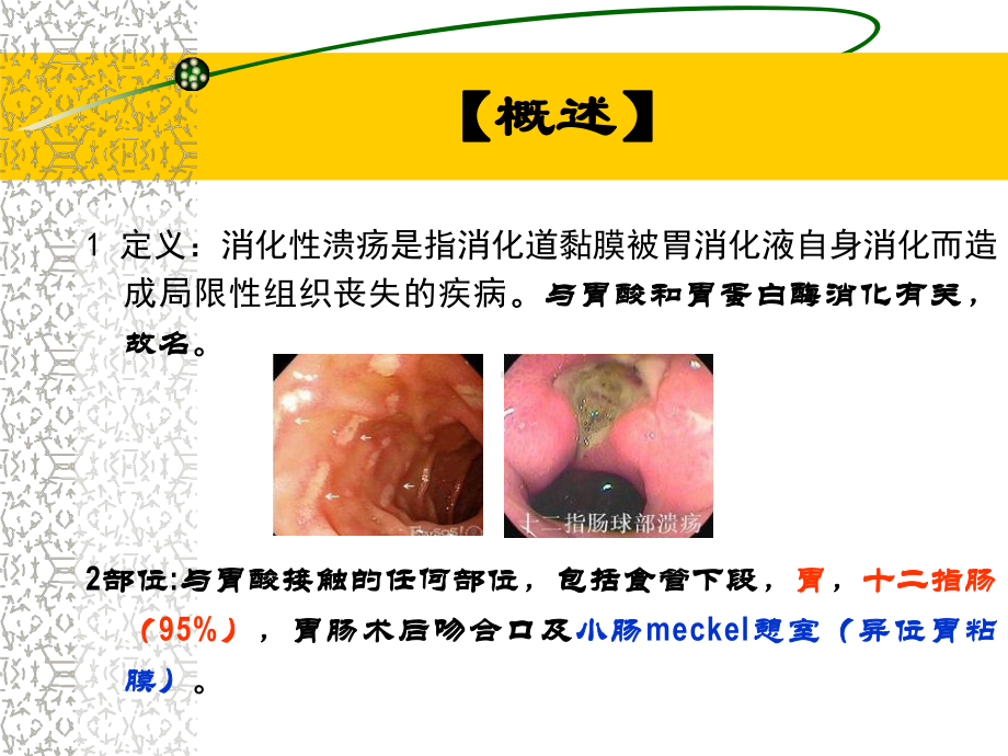 小儿消化性溃疡课件.ppt_第2页