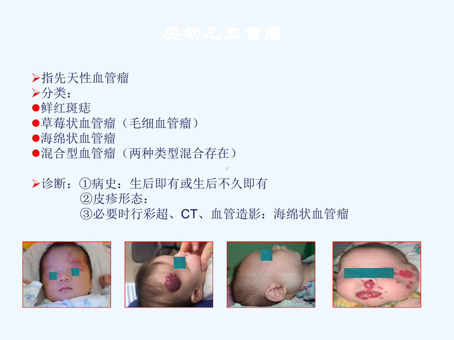 婴幼儿皮肤血管瘤的治疗进展课件.ppt_第3页