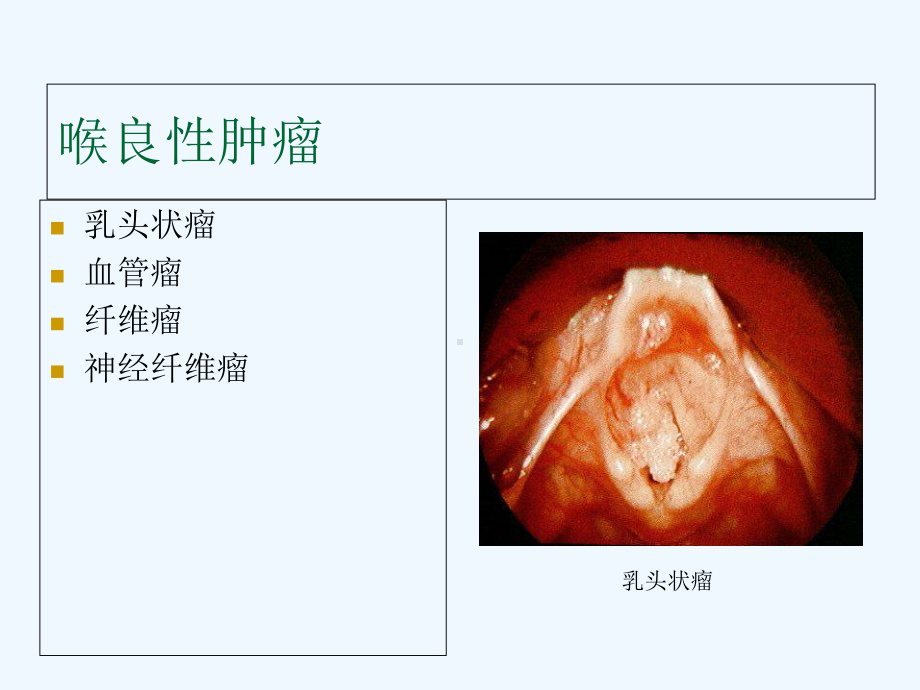 耳鼻咽喉头颈外科学-喉肿瘤课件.ppt_第3页