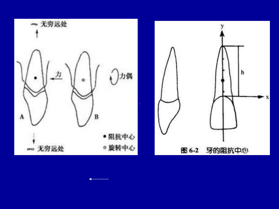 正畸治疗的生物机械原理口腔医学课件.ppt_第3页