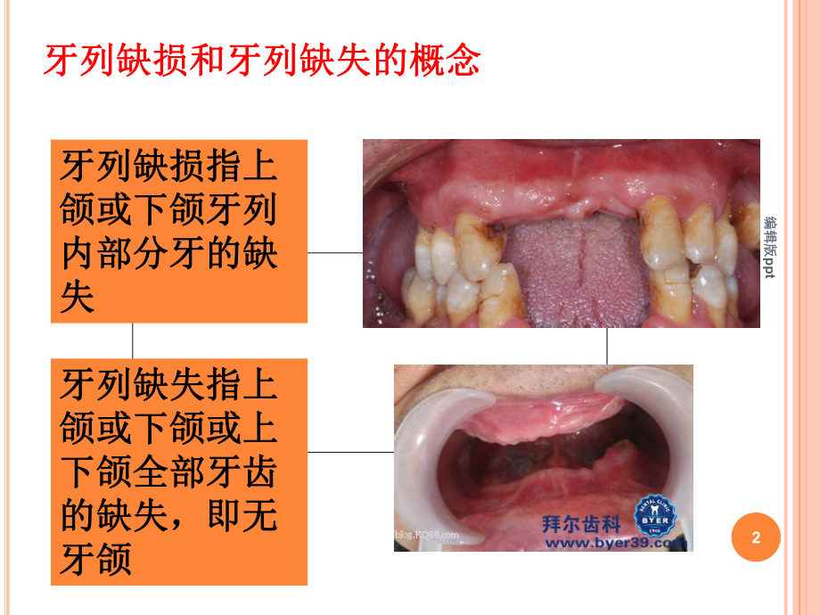 口腔修复PPT课件1.ppt_第2页