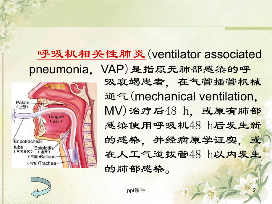 呼吸机相关性肺炎的预防及护理-ppt课件.ppt_第2页