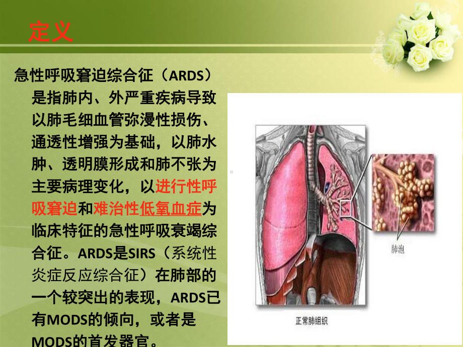 急性呼吸窘迫综合症的急救护理课件.ppt_第2页