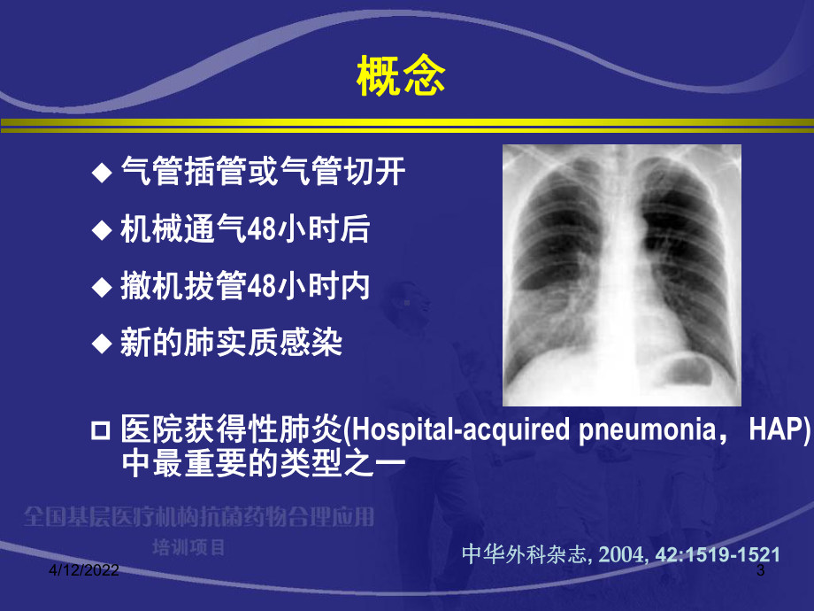 呼吸机相关性肺炎-(2)课件.ppt_第3页