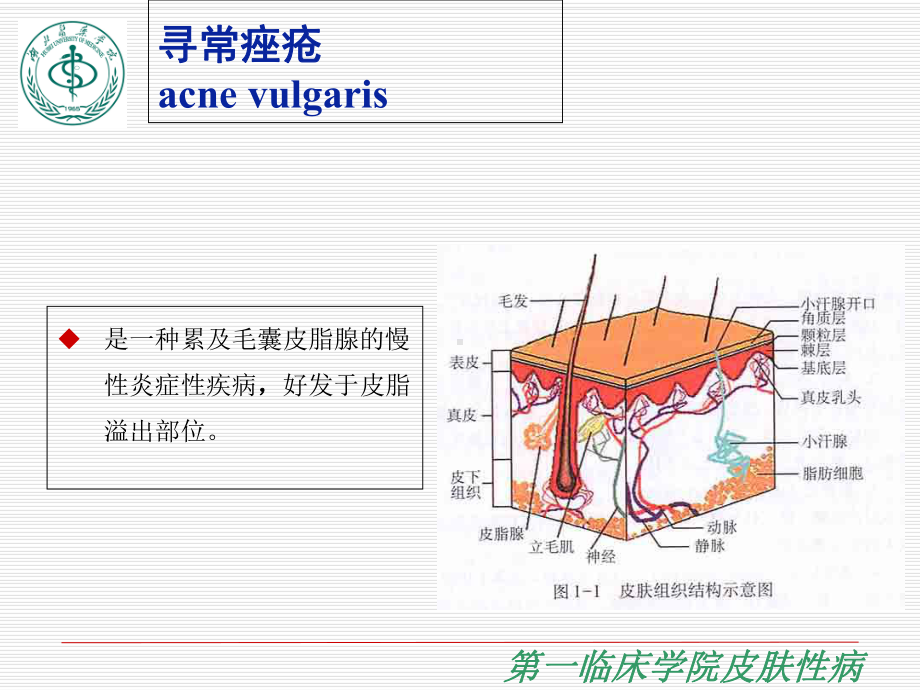 痤疮医学知识讲座优质PPT课件.ppt_第3页