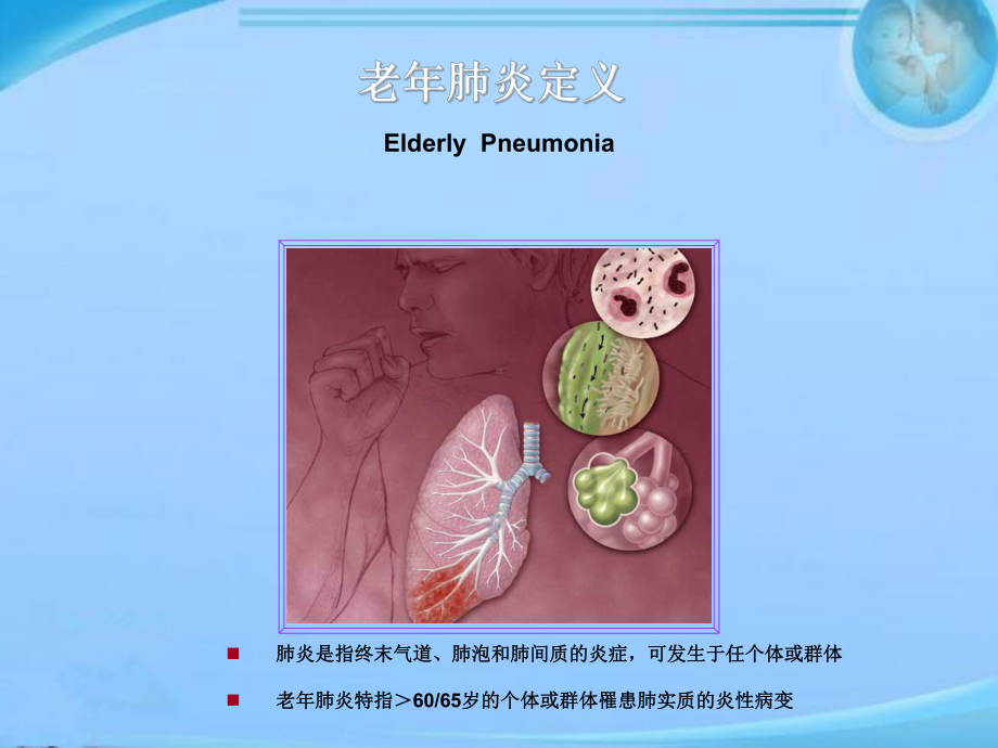 老年肺炎-ppt课件.ppt_第3页