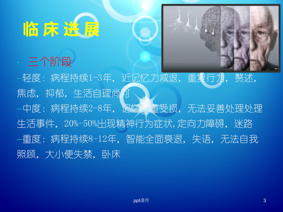 老年痴呆的护理-ppt课件.ppt_第3页