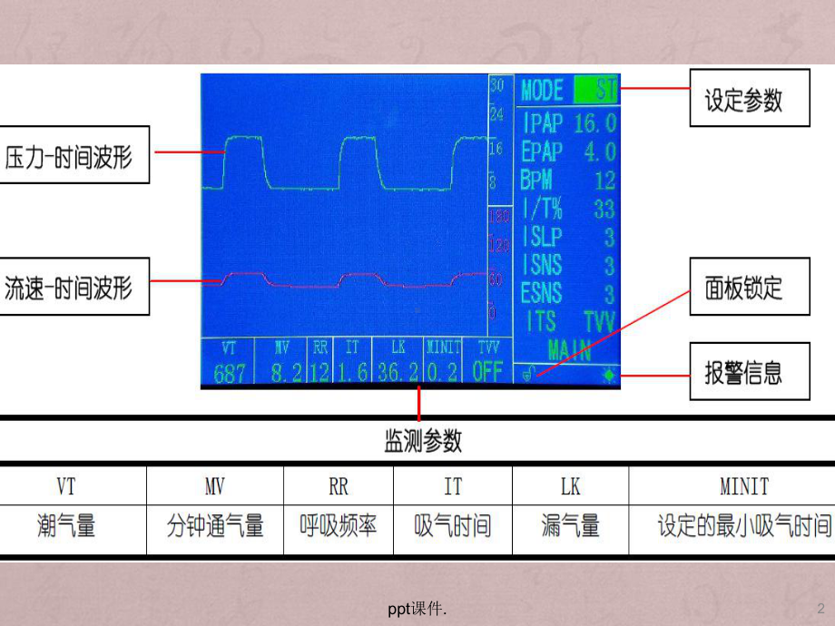 FLEXO无创呼吸机参数调节ppt课件.pptx_第2页