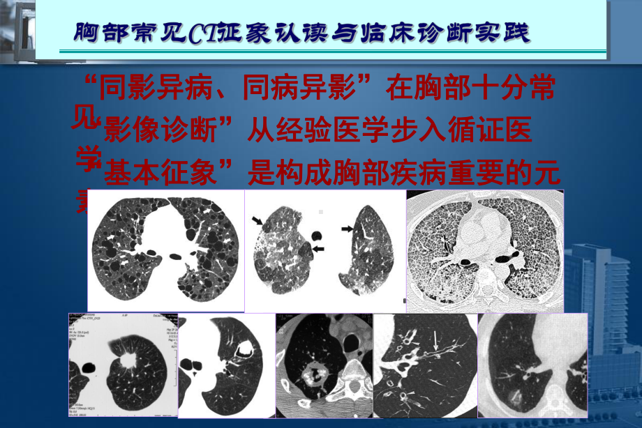 影像诊断01-呼吸系统课件.ppt_第3页