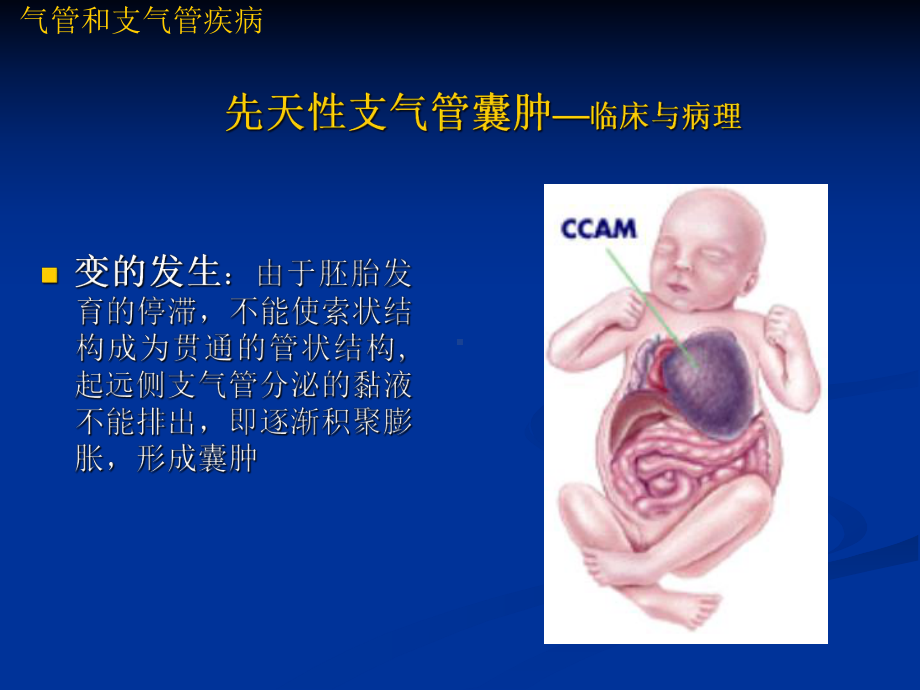 第6章-呼吸系统课件.ppt_第3页