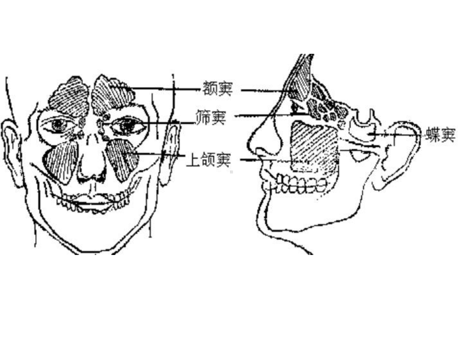 呼吸系统疾病患儿的护理ppt课件.ppt_第3页