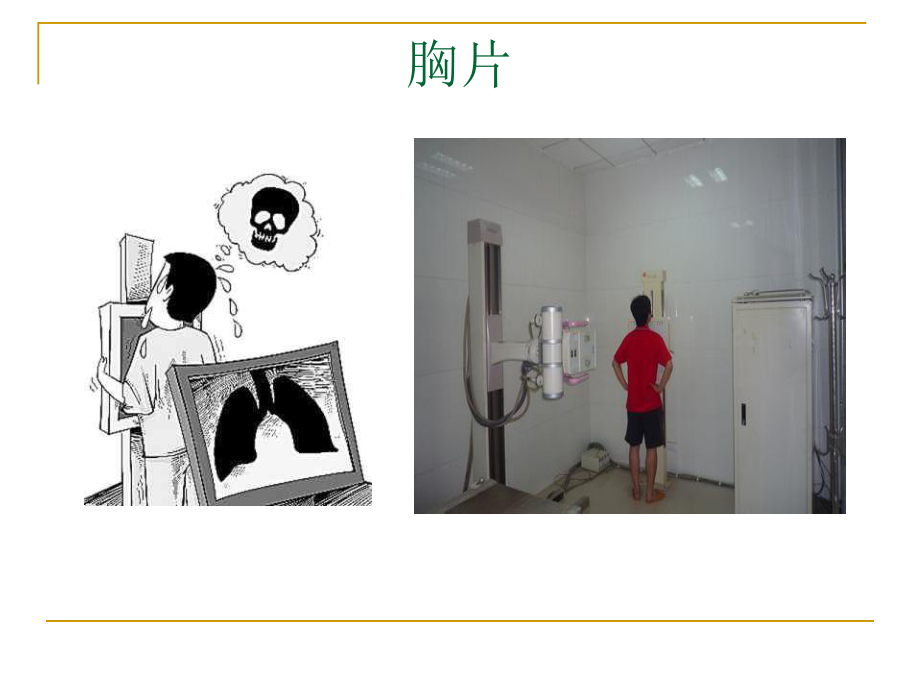 呼吸科X线、CT带教(正常、基本病变均包含)课件.ppt_第2页