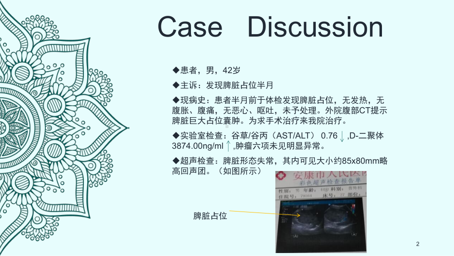 脾脏窦岸细胞血管瘤影像病例讨论PPT课件.ppt_第2页