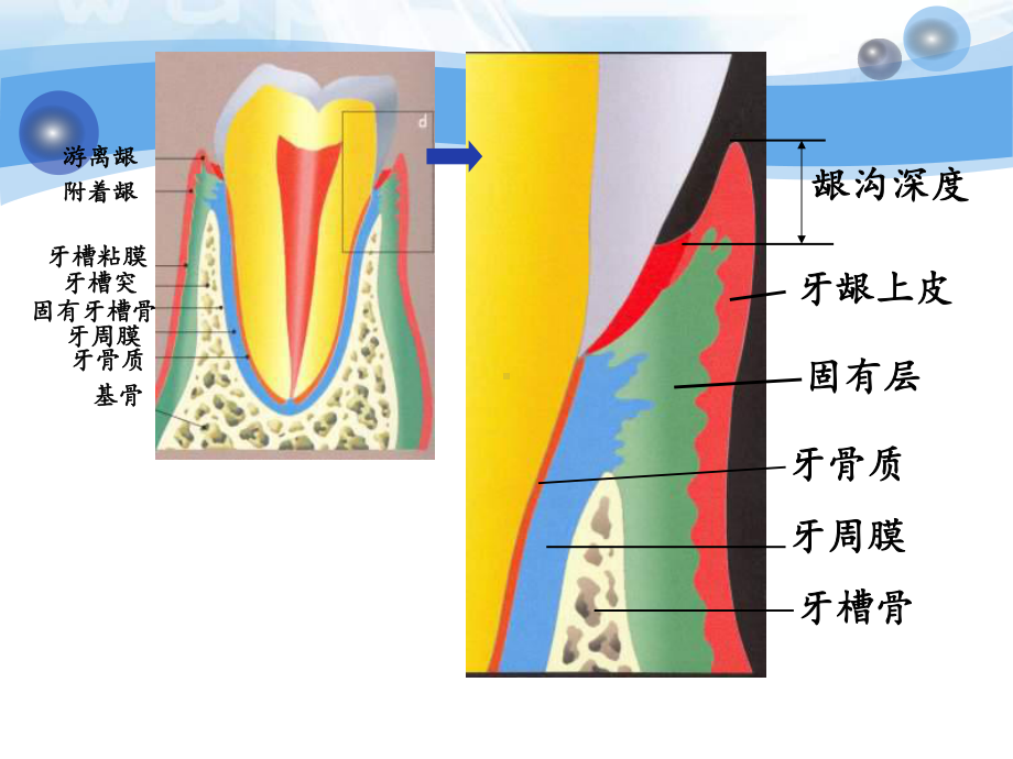 儿童口腔病学牙周组织疾病及常见粘膜病课件.ppt_第3页