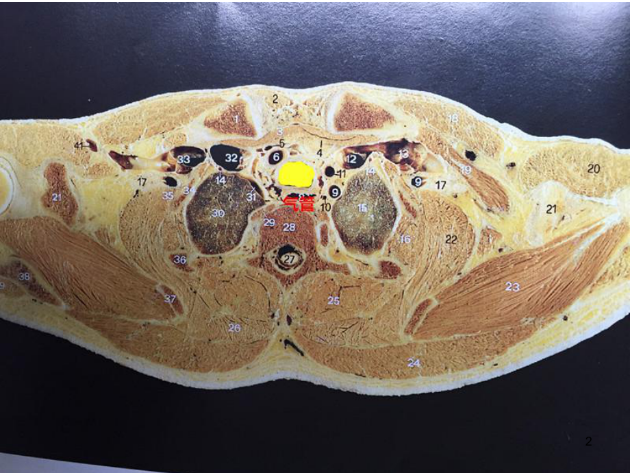 胸部断层解剖图谱呼吸系统课件.ppt_第2页