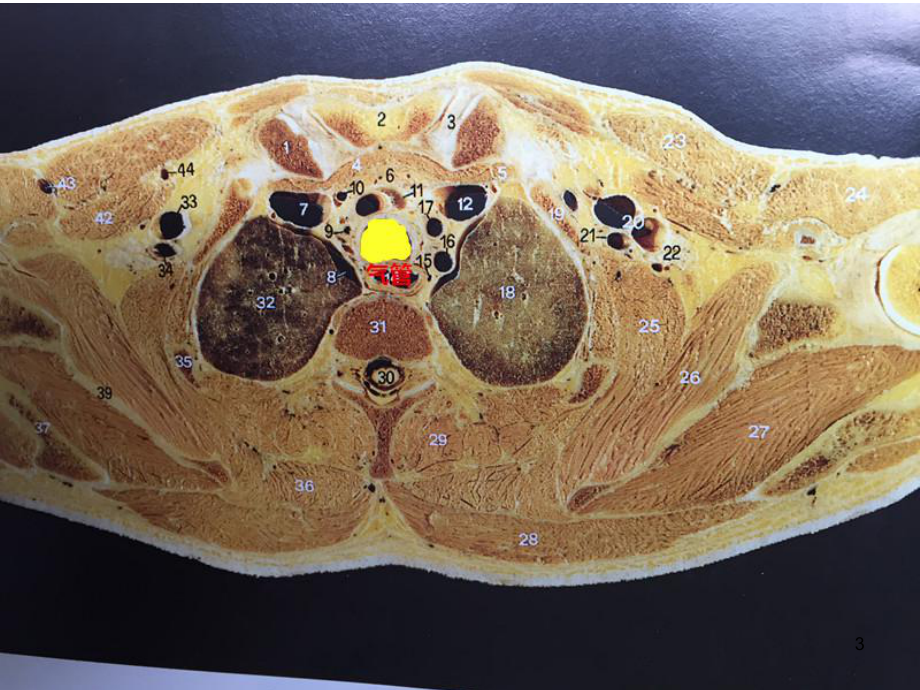胸部断层解剖图谱呼吸系统课件.ppt_第3页