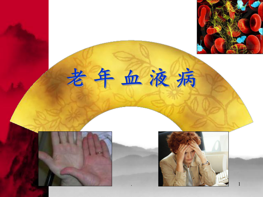 老年血液病PPT课件.ppt_第1页