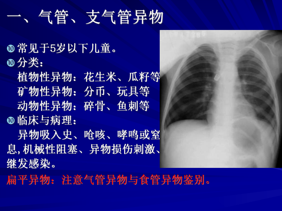 呼吸系统常见疾病影像诊断课件.ppt_第2页