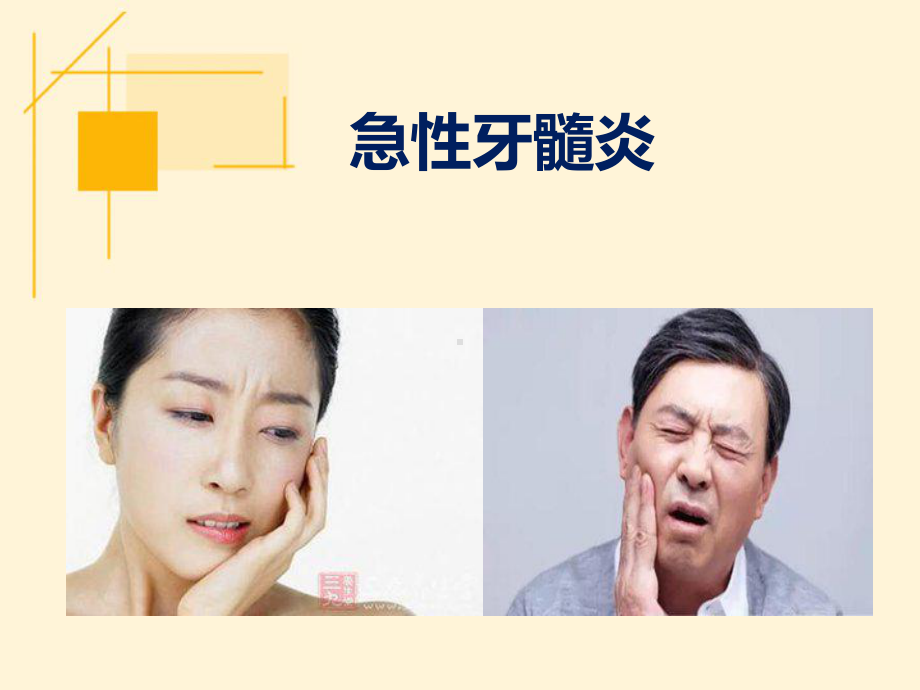 急性牙髓炎ppt演示课件.ppt_第1页