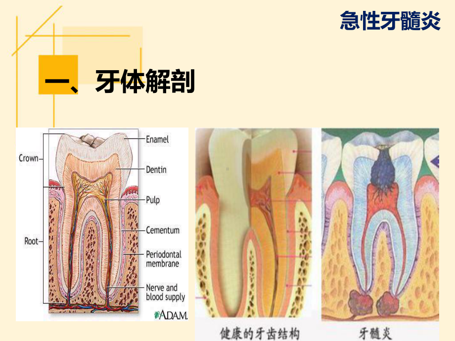 急性牙髓炎ppt演示课件.ppt_第3页