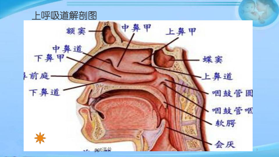 小儿上呼吸道感染-ppt课件.ppt_第3页