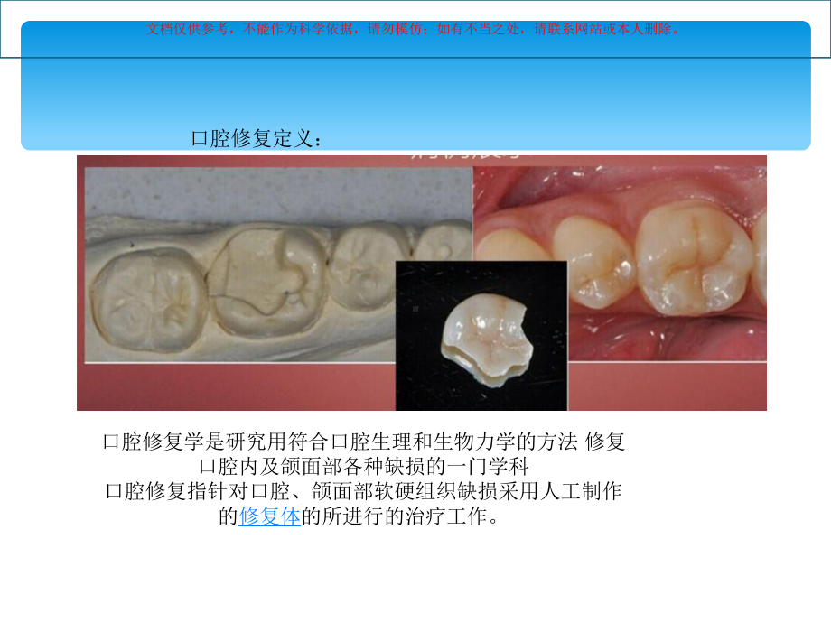 口腔修复讲课课件(同名301).ppt_第2页