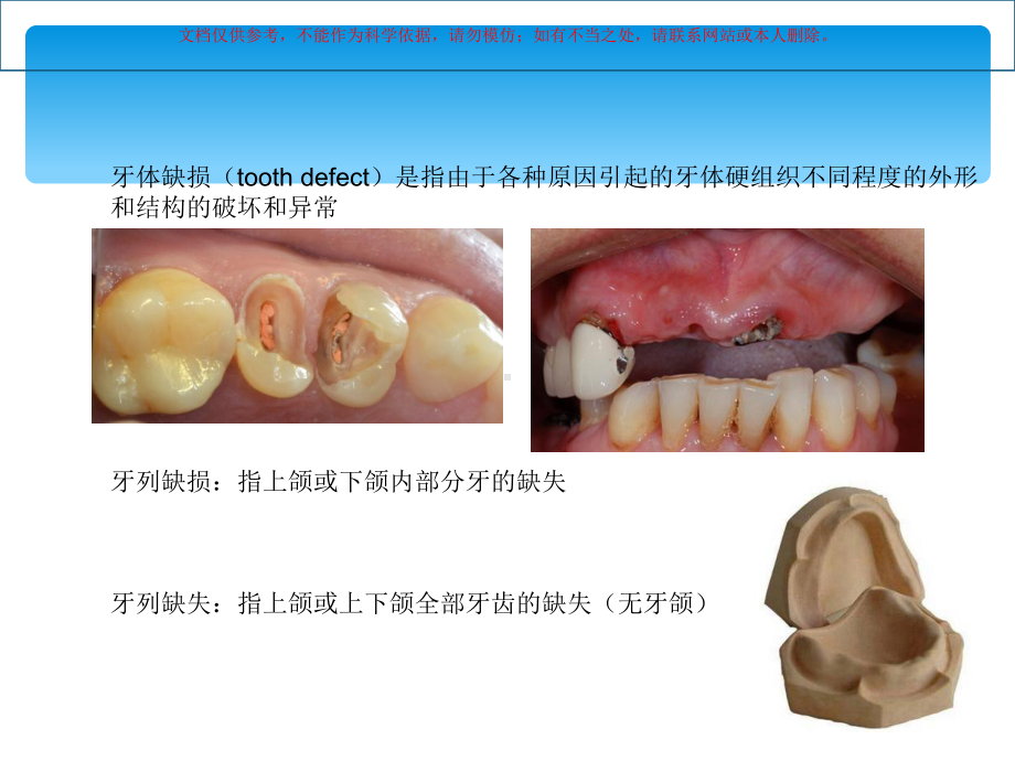 口腔修复讲课课件(同名301).ppt_第3页