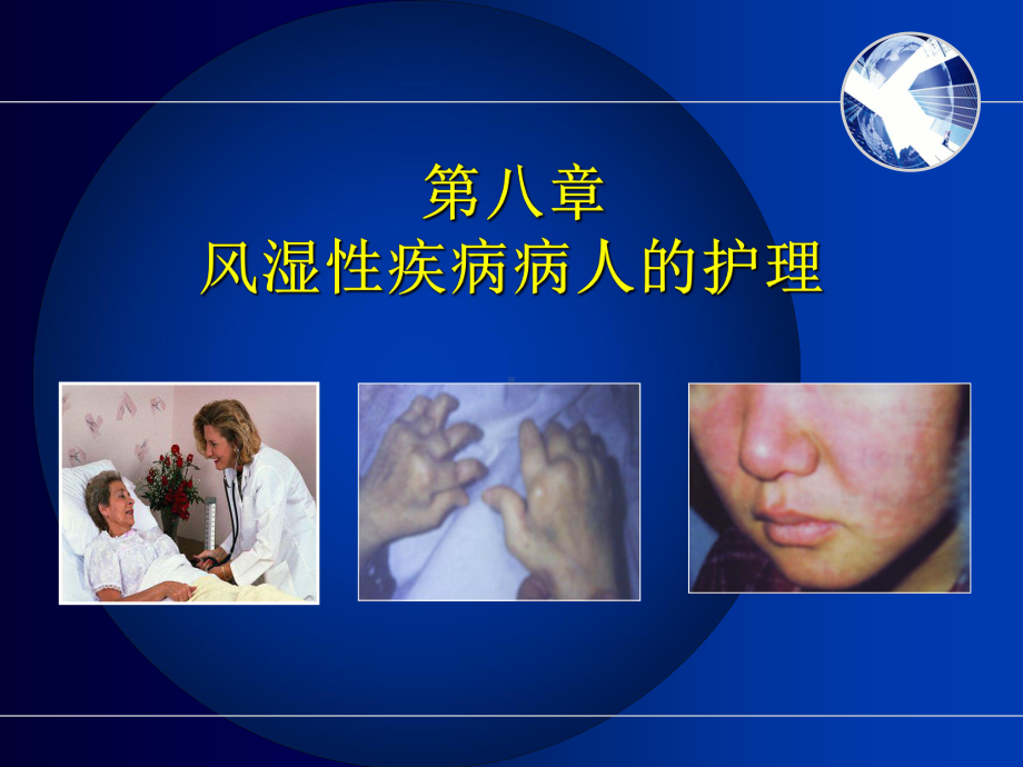 系统性红斑狼疮病人的护理(1)课件.ppt_第1页