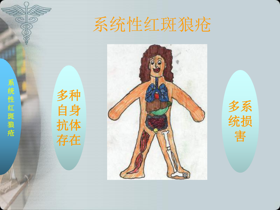 系统性红斑狼疮(SLE)课件.ppt_第3页