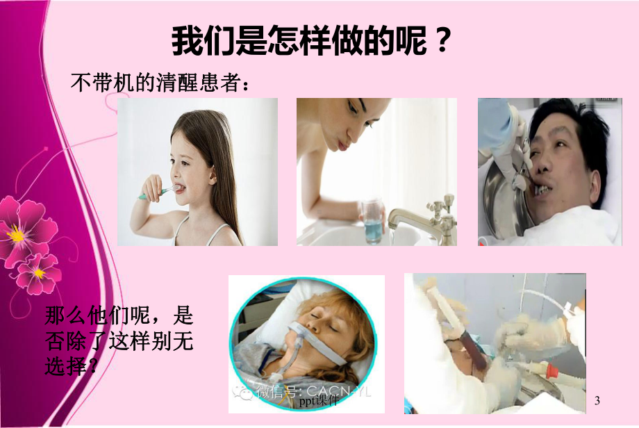 气管插管病人的口腔护理-ppt课件.ppt_第3页