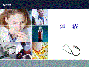 痤疮PPT课件.ppt