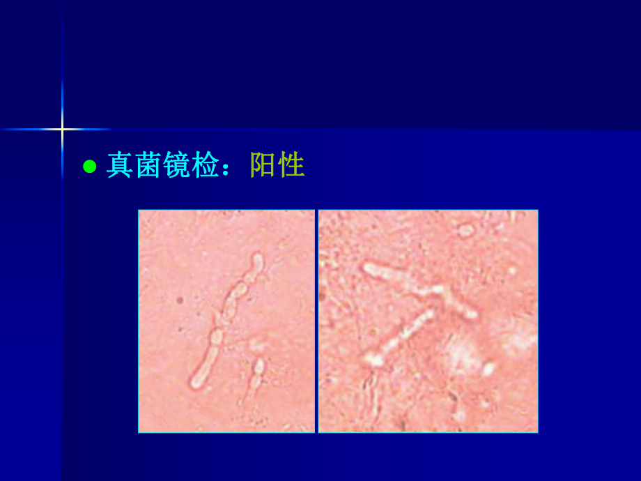 皮肤科典型病例展示二课件.ppt_第3页